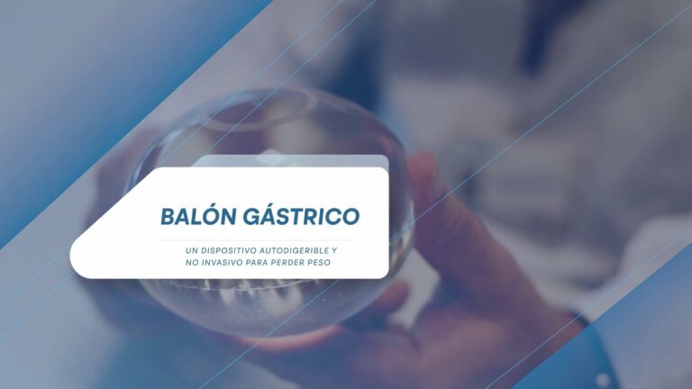 Beneficios del balón gástrico cubierto por la seguridad social